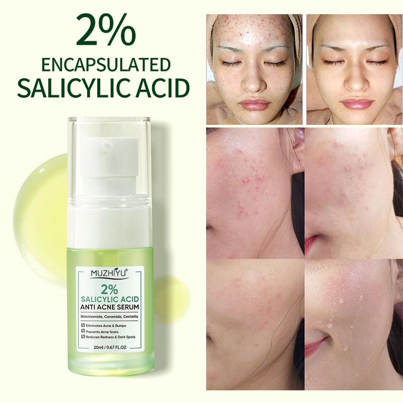 Acne Serum Factory - Private Label Salicylic Acid Removal