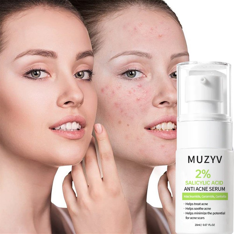 Acne Serum Manufacturer - Organic Salicylic Acid Treatment