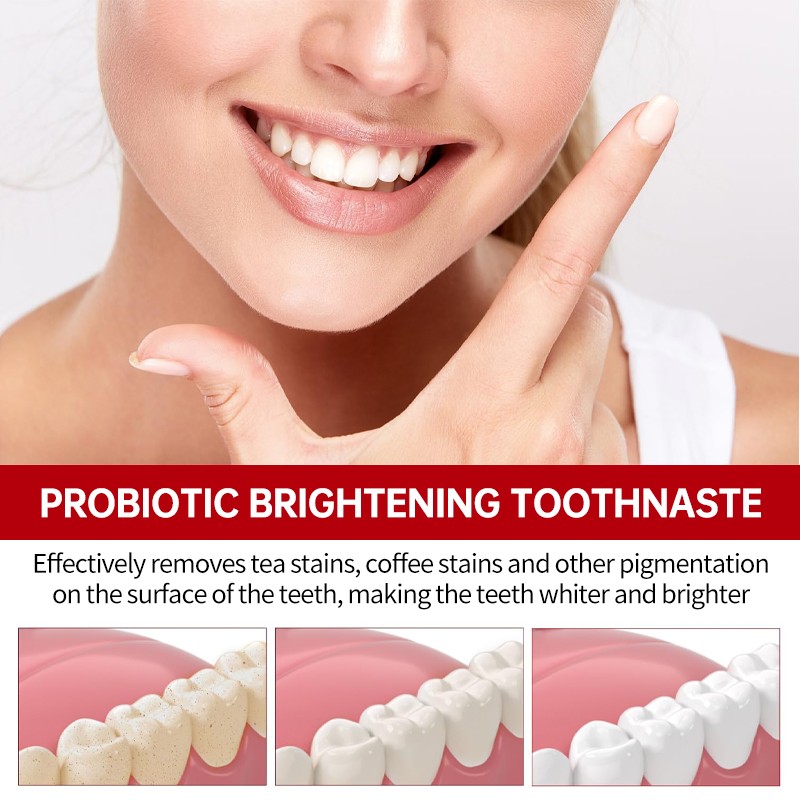 Probiotics Toothpaste Manufacturer - OEM Herbal Gum Care