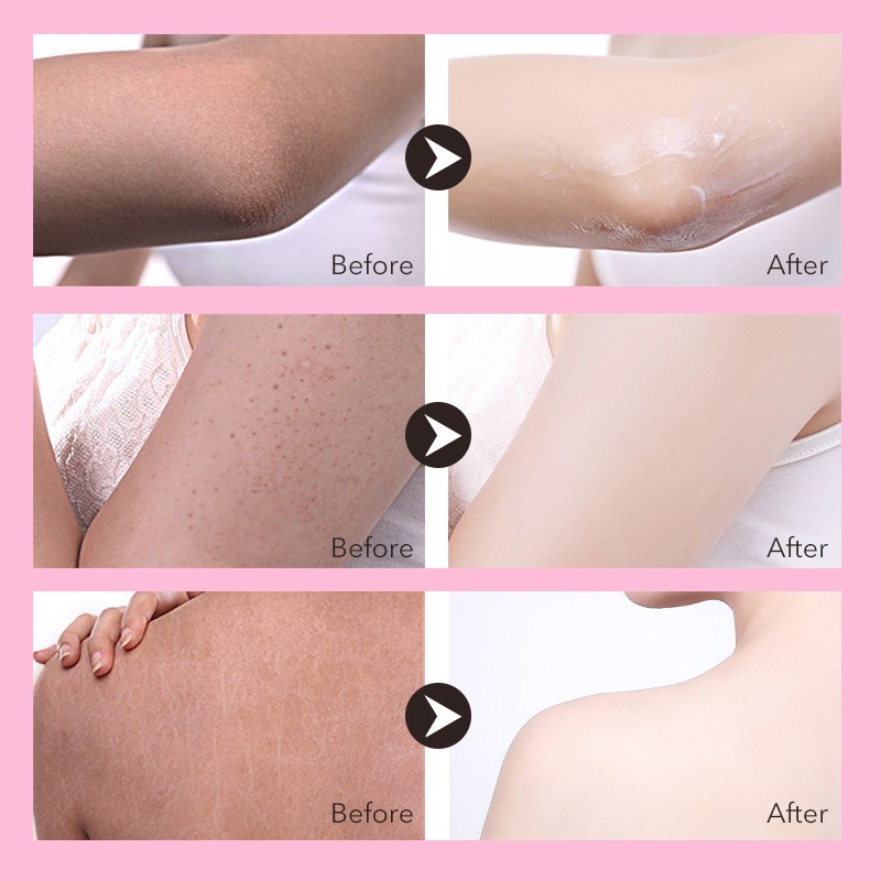 Body Cream Factory - Custom OEM Lightening Top Quality