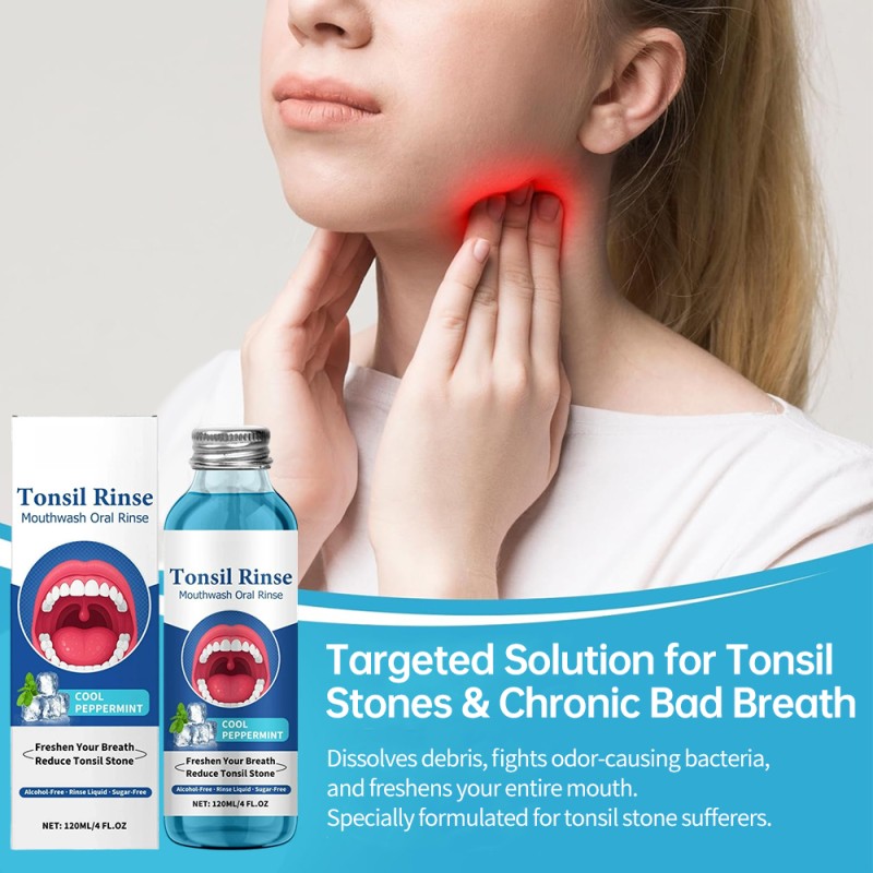 Mouthwash Liquid Supplier - OEM Tonsil Stone Remover Alcohol Free