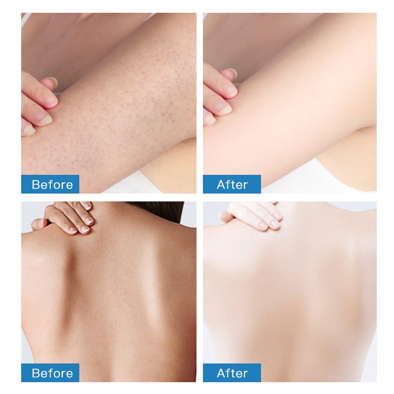 Body Scrub Factory - OEM Customizable Whitening Exfoliating