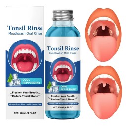 Mouthwash Liquid Supplier - OEM Tonsil Stone Remover Alcohol Free