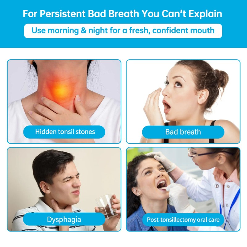 Mouthwash Liquid Supplier - OEM Tonsil Stone Remover Alcohol Free