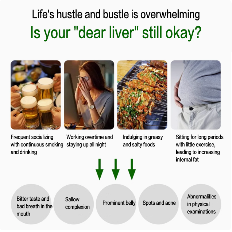 Milk Thistle Capsules Factory - OEM Liver Health Herbal Protect