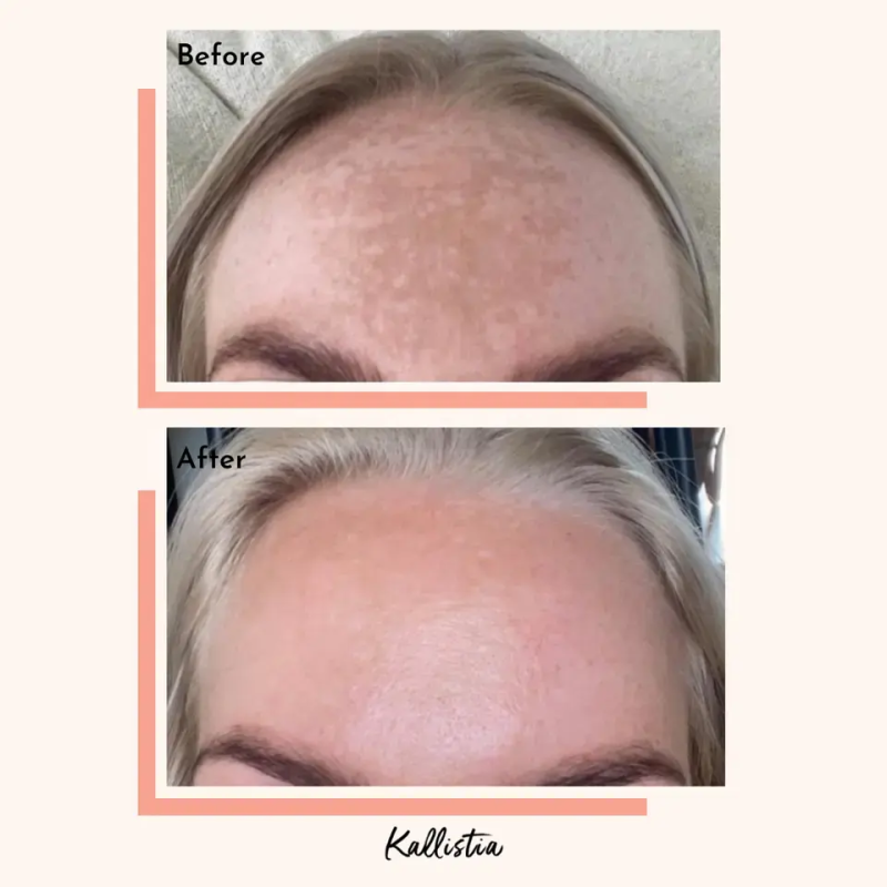 Skin Cleanse Capsules Factory - OEM Custom Vegan Oily Skin Dark Spot