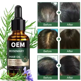 Rosemary Hair Oil Drops Manufacturer - OEM ODM Natural Organic Hair Growth