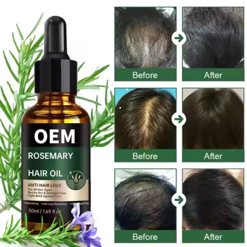 Rosemary Hair Oil Drops Manufacturer - OEM ODM Natural Organic Hair Growth