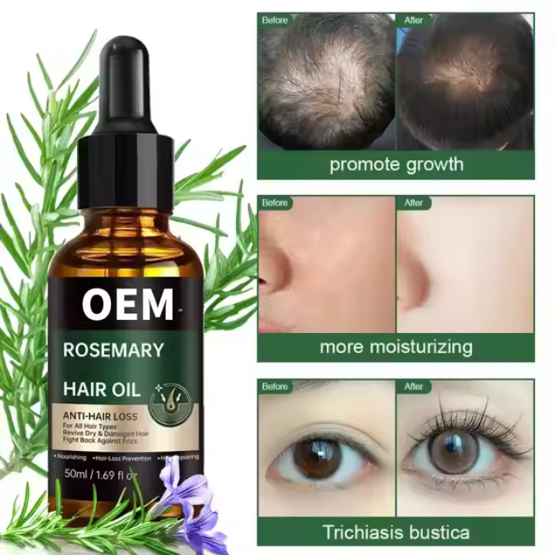 Rosemary Hair Oil Drops Manufacturer - OEM ODM Natural Organic Hair Growth