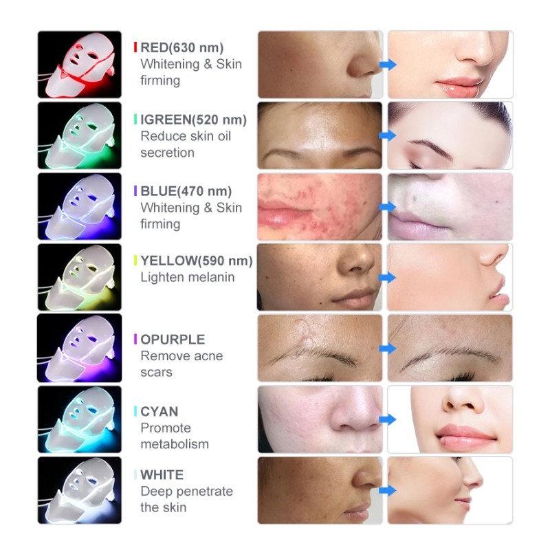 Stretch Mark Removal Kit Factory - Titanium Therapy 1mm Body