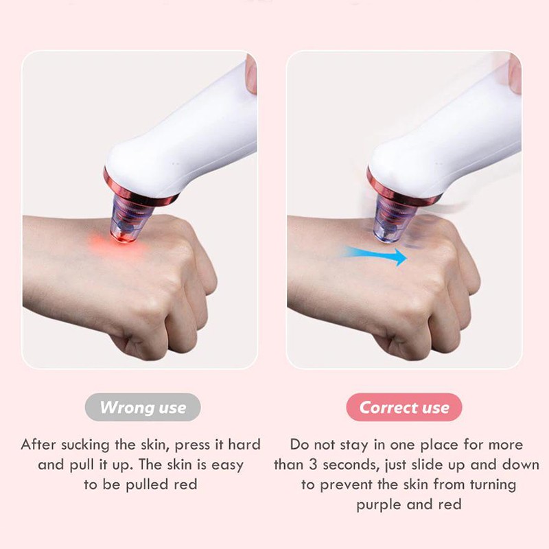 Professional Skin Scrubber Factory - Waterproof Ultrasound Facial