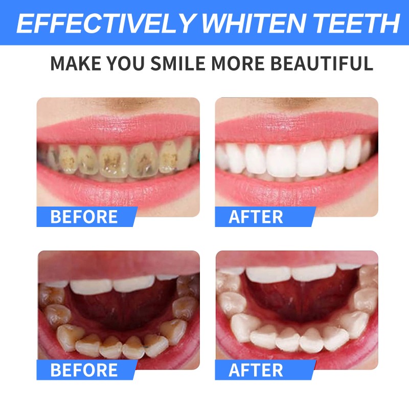 Travel Toothpaste Factory - Day Night Whitening OEM Charcoal