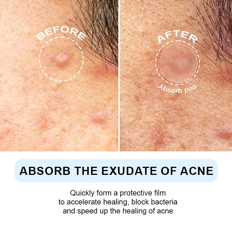 Lip Balm Supplier - Moisturizing Colorless Anti-dryness