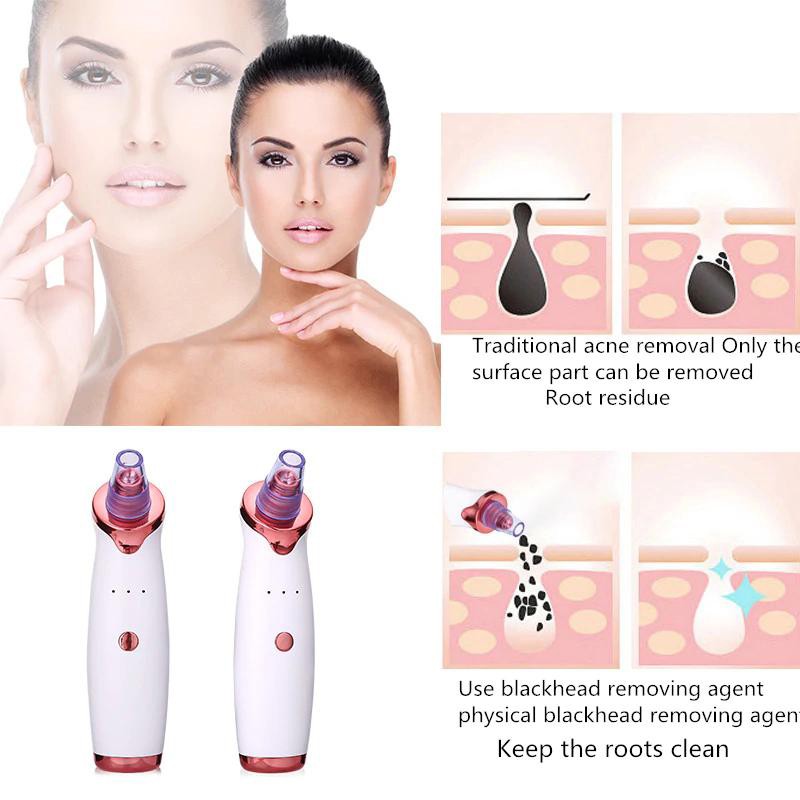 Professional Skin Scrubber Factory - Waterproof Ultrasound Facial