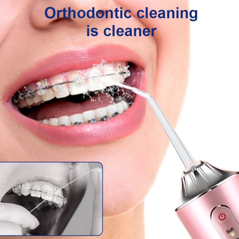 Oral Irrigator Supplier - Mini USB Rechargeable Travel