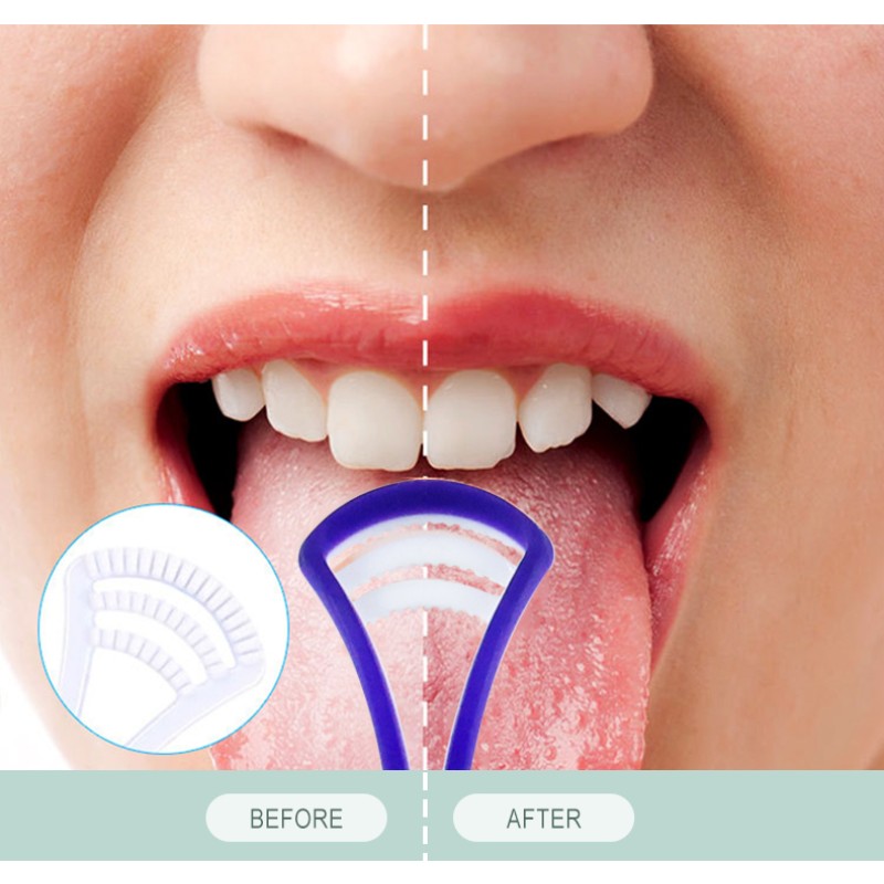 Blackhead Remover Manufacturer - Hot Sale Vacuum Derma Graisse