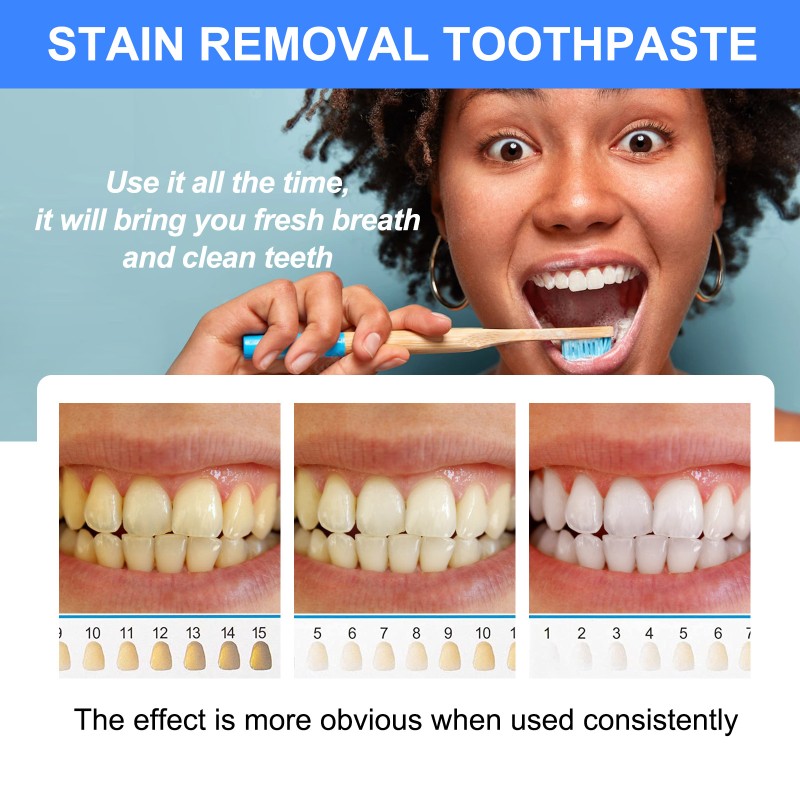 Teeth Care Toothpaste Manufacturer - Wholesale Soda Blueberry Whitening