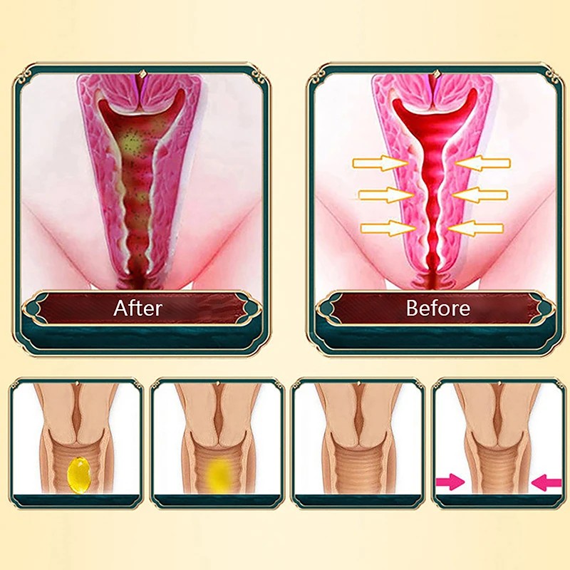 Hot Sale Vaginal Tightening Vagina Shrinking Feminine Hygiene Repair Stick Firming Vagina Female Private Care