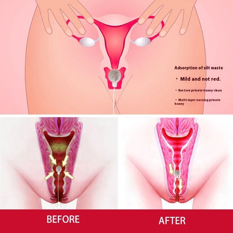 Clean Point Hygiene Products Vaginal Detox Pearl Swab Tampons Chinese Herbal Health Care Yoni Pearls