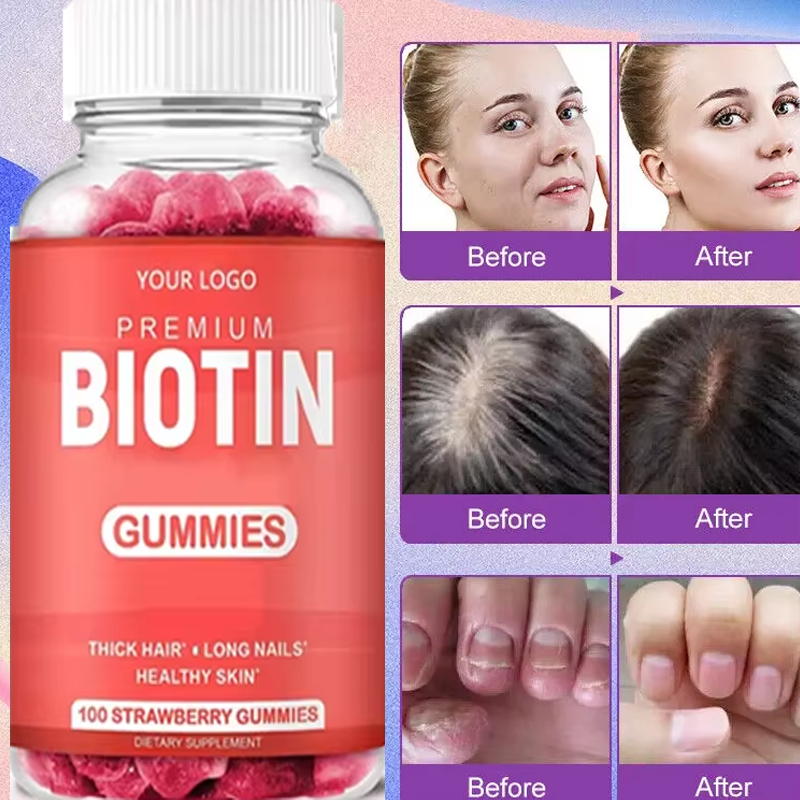 Biotin Gummies Supplier - Private Label Hair Growth Women