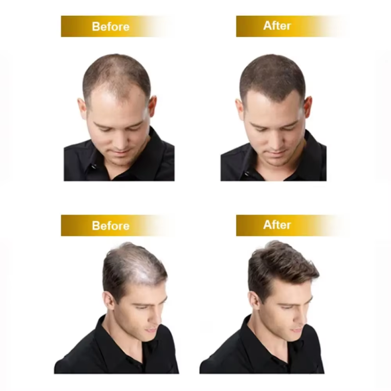 Biotin Gummies Supplier - Private Label Hair Growth Women