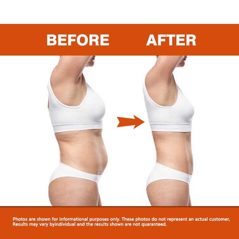 Slimming Capsules Factory - Factory Wholesale Price ACV Weight Management Energy