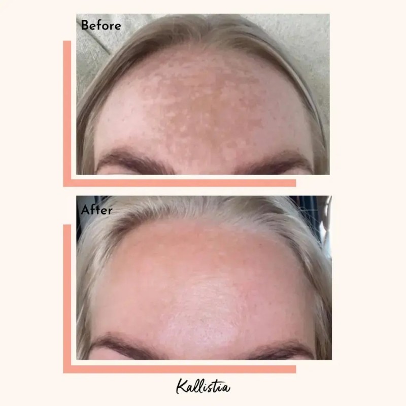 Healthcare Capsules Factory - OEM Skin Care Hyperpigmentation Vegan Cleanse