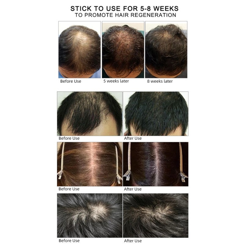 Hair Treatment Manufacturer - 30ml Organic Damaged Care