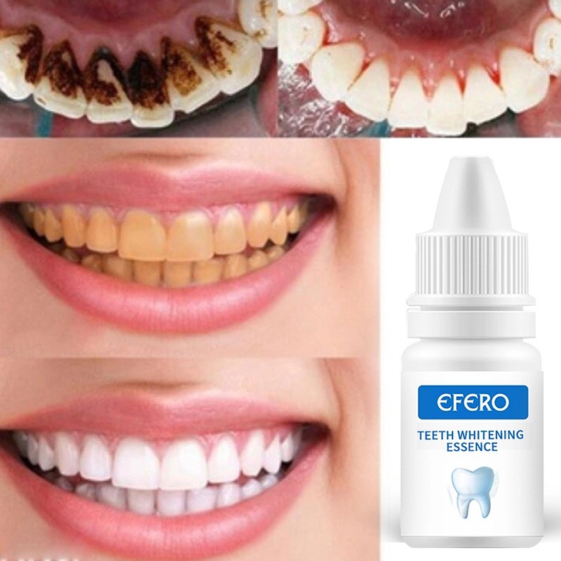 Teeth Whitening Gel Supplier - Organic Multi Purpose Removes Plaque Dental Care
