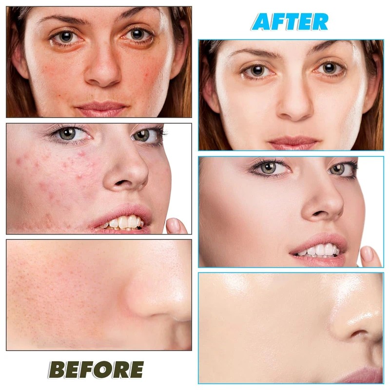 Cleansing Pads Factory - Custom Wholesale Brightens Energizes Kojic Acid