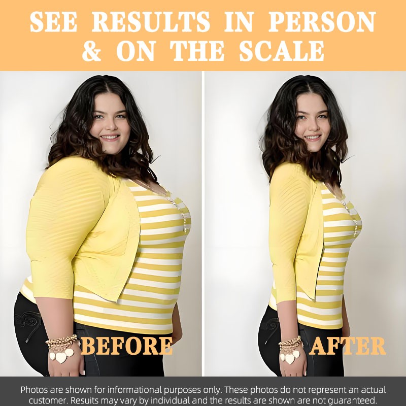 Fat Burner Gummies Factory - Private Label Weight Loss Slimming Products