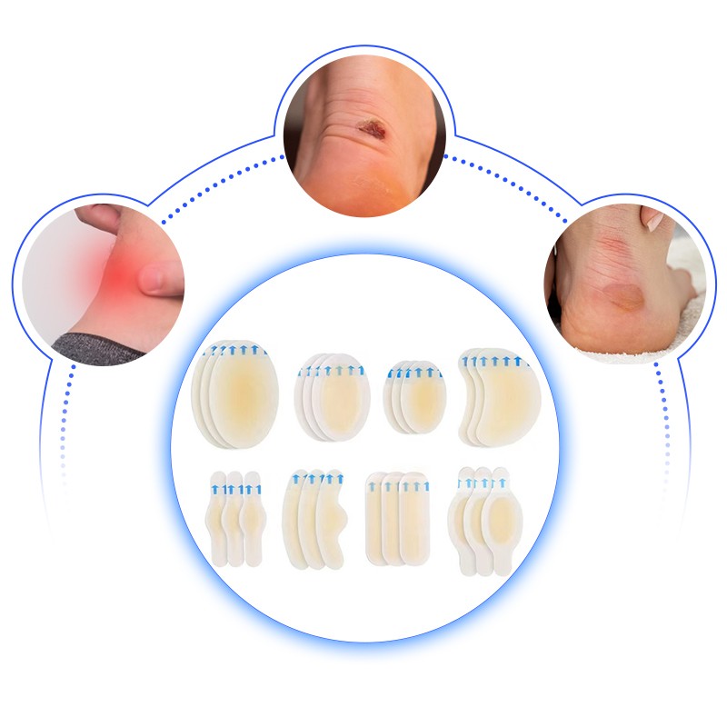 Hydrocolloid Foot Patch Manufacturer - Custom Blister Dressing Support
