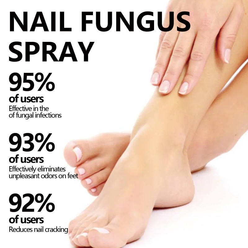 XIMONTH Nail Care Soothing Repairing Natural Nail Fungus Treatment Serum Spray 100ml