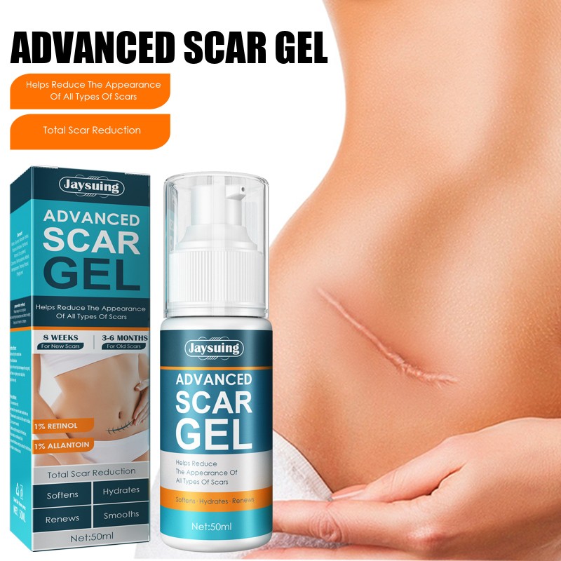 Acne Scar Cream Gel Skin Care Stretch Marks Acne Spots Surgical Scars Beauty Cosmetics