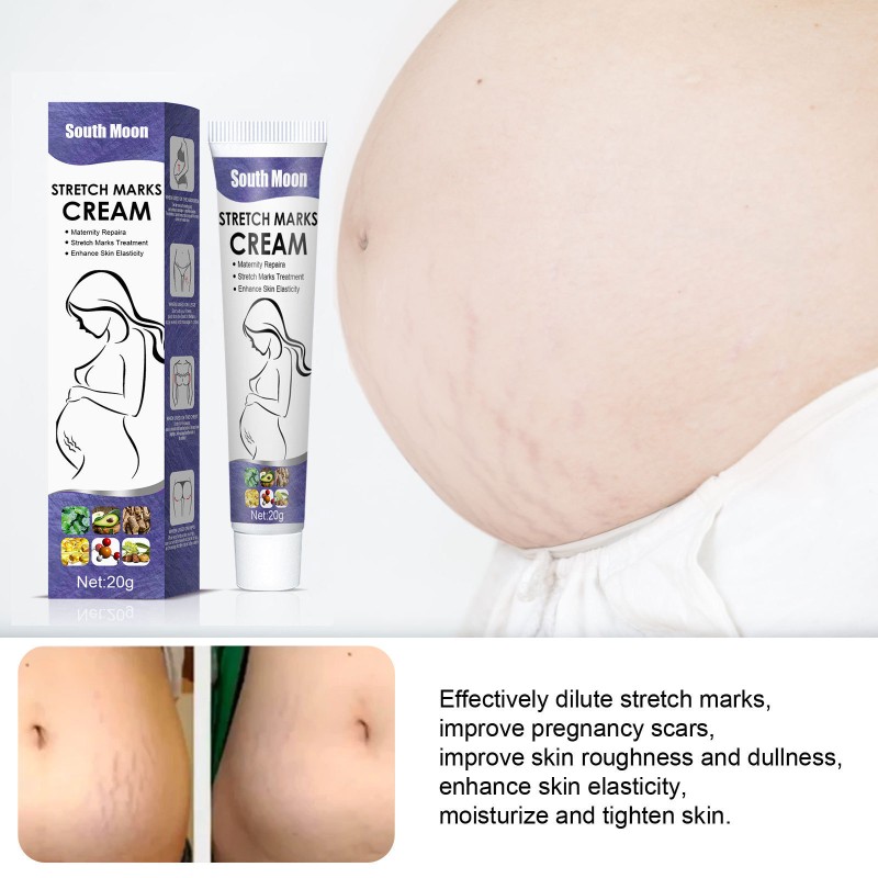 South Moon Belly Buster Stretch Mark Removal Cream 20g in Tube Women Abdomen Powerful Stretch Mark Repair Cream