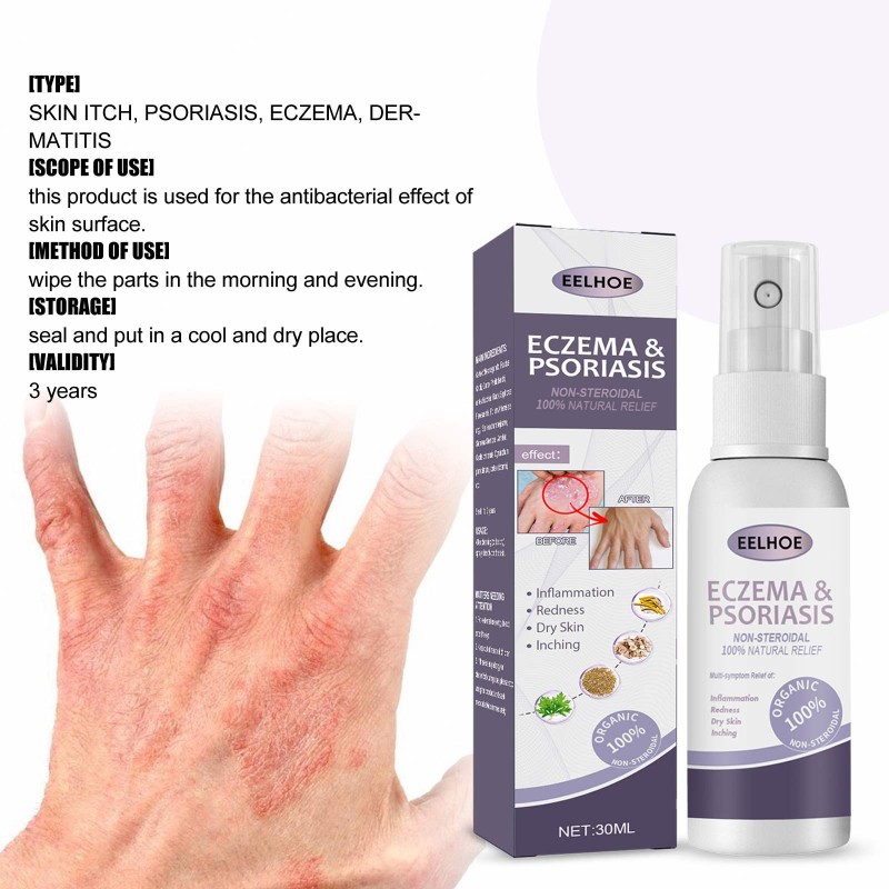 EELHOE Wholesale OEM Health Care Supplies Psoriasis Cream Eczema Herbals Spray for Skin Care