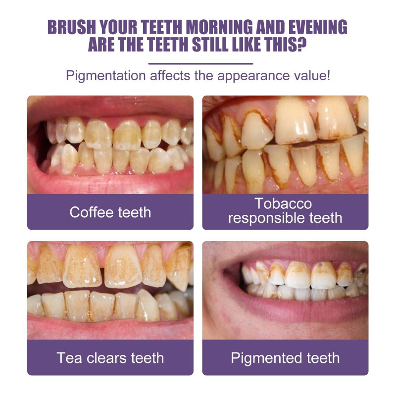 Deep Cleaning Teeth Whitening Powder Fresh Breath Oral Hygiene Dentally Remove Plaque Stains Multi-Purpose Teeth Accessories