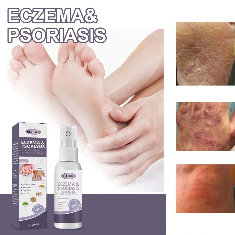 EELHOE Wholesale OEM Health Care Supplies Psoriasis Cream Eczema Herbals Spray for Skin Care