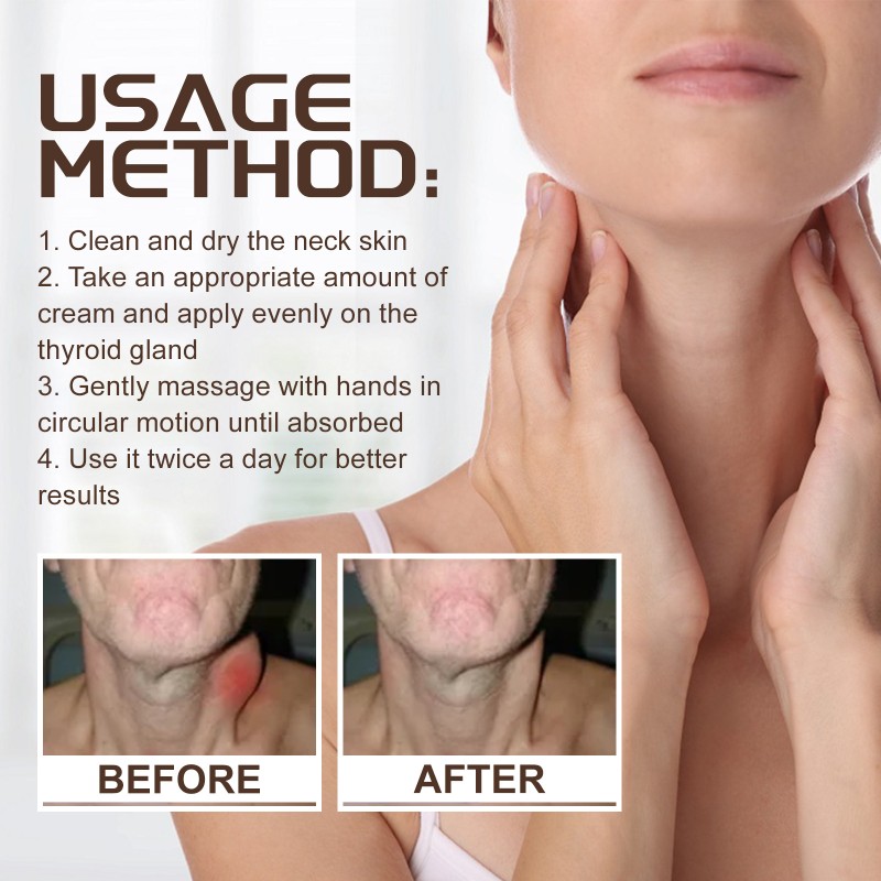 South Moon OEM Lymphatic Repair Cream Relieve Neck and Armpit Lymphatic Swelling Discomfort Body Health Care Patch