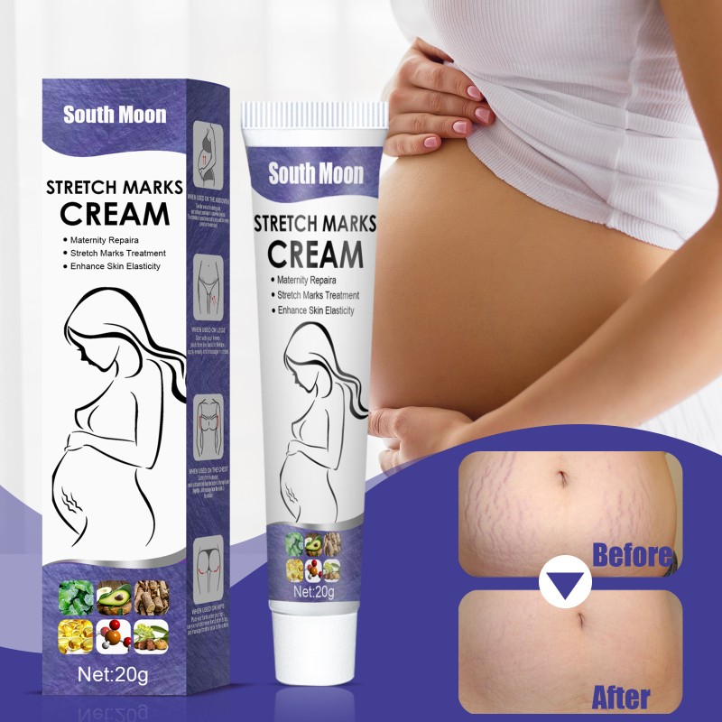 South Moon Belly Buster Stretch Mark Removal Cream 20g in Tube Women Abdomen Powerful Stretch Mark Repair Cream