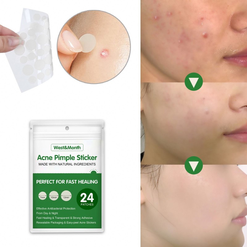 Acne Patch Factory - West&Month Acne Pimple Remover Waterproof Stickers