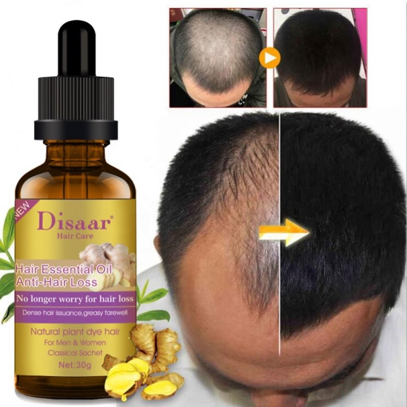 Hair Growth Serum Factory - OEM Private Label Plant Herbal Ginseng Biotin