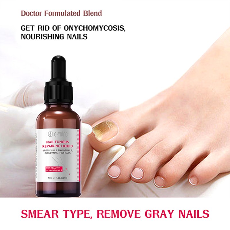 Nail Repair Essence Manufacturer - Sample+OEM/ODM Foot Fungus Treatment