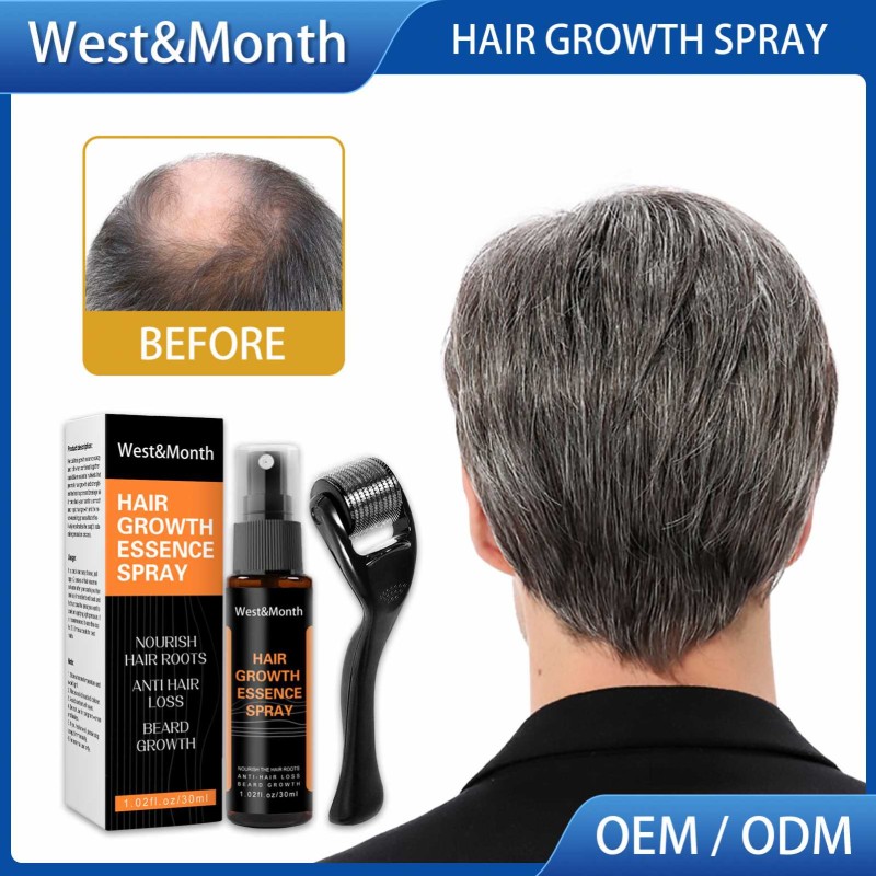 Hair Growth Spray Manufacturer - Hot Sale Natural Anti Hair Loss Men