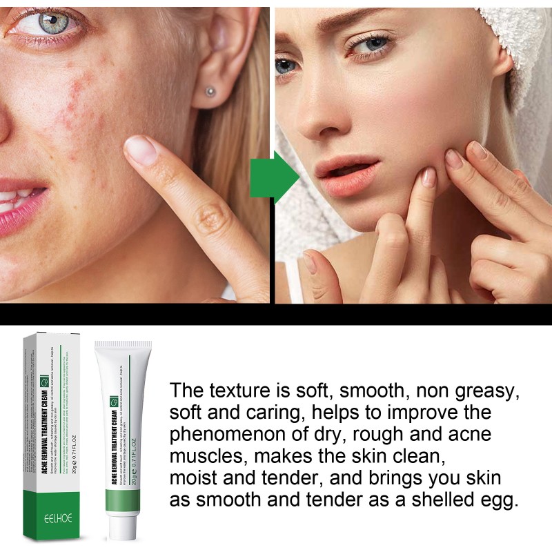 Whitening Cream Manufacturer - Best Seller Moisturizing Oil Control Spot