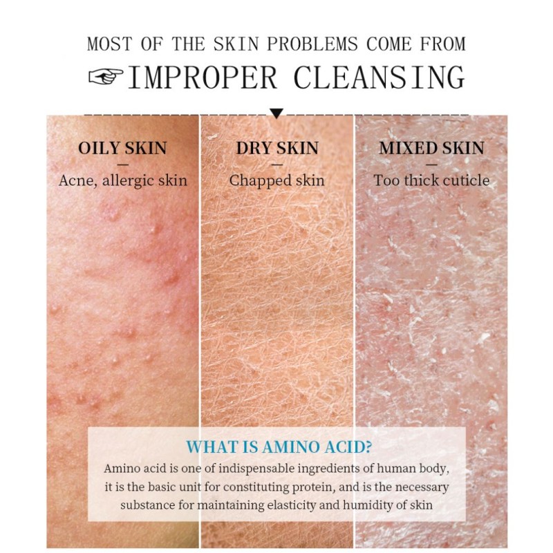 Facial Cleanser Supplier - for Sensitive Acne Oil Control Korean Skin