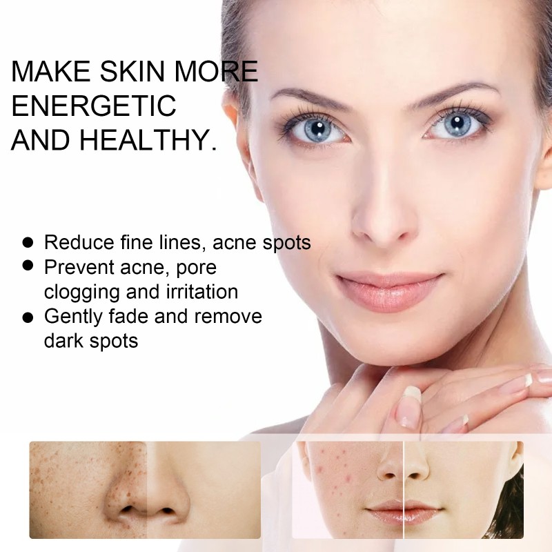 Whitening Cream Manufacturer - Best Seller Moisturizing Oil Control Spot