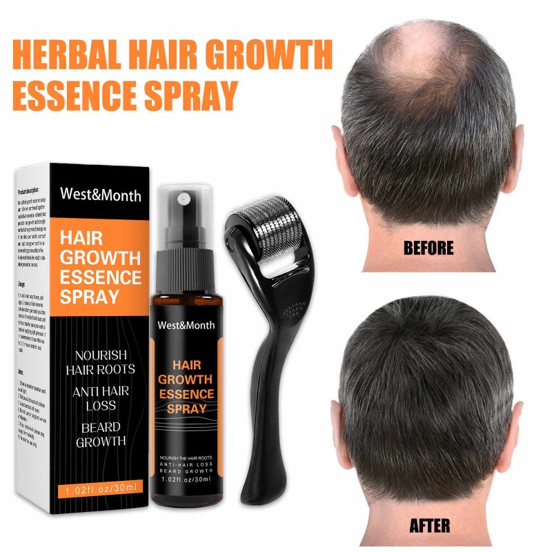 Hair Growth Spray Manufacturer - Hot Sale Natural Anti Hair Loss Men