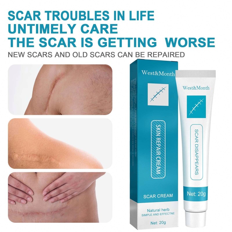 Scar Removal Cream Factory - West&Month Oem Scar Removal Pimples Marks