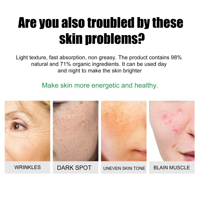 Whitening Cream Manufacturer - Best Seller Moisturizing Oil Control Spot